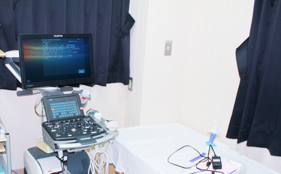 超音波診断装置